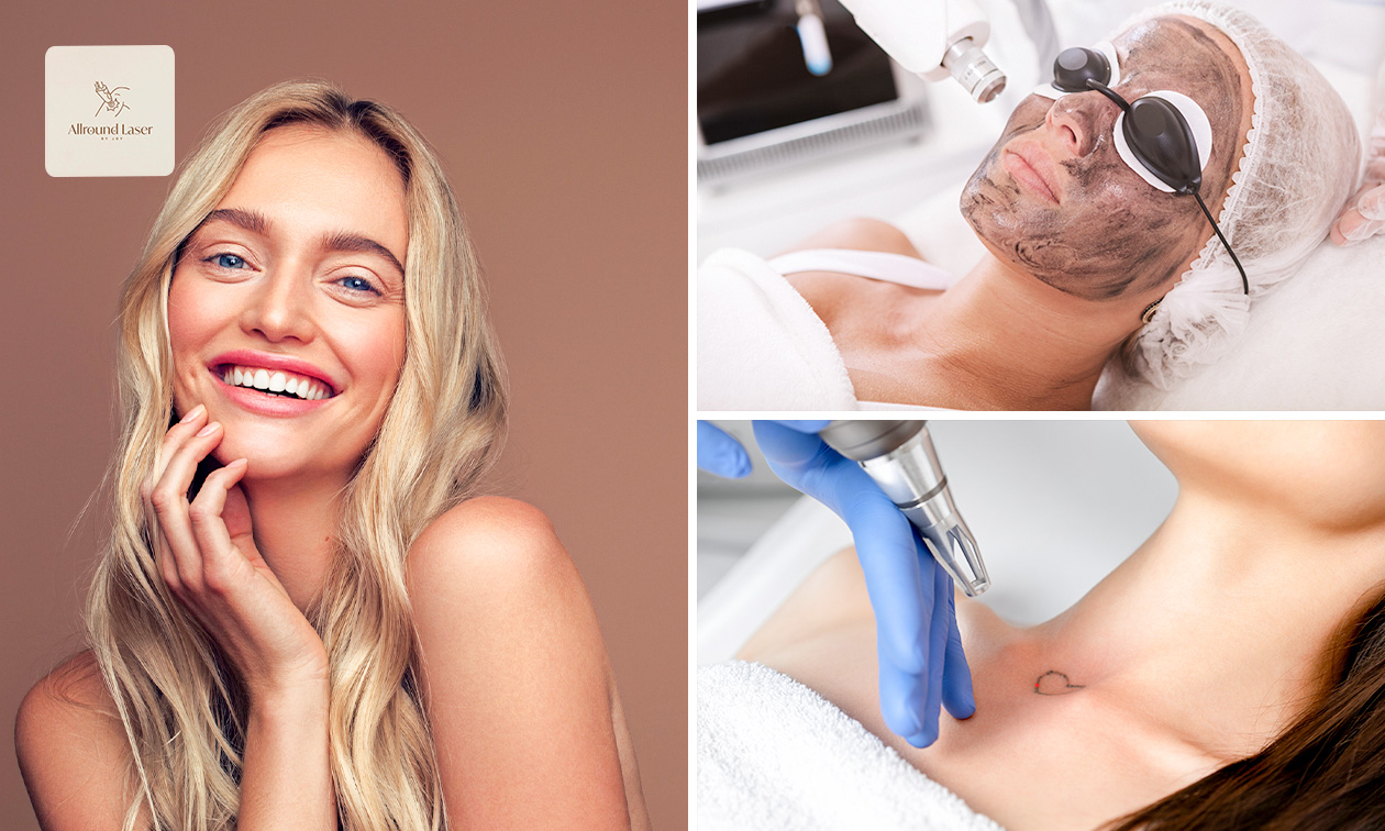 Allround laser by Joy