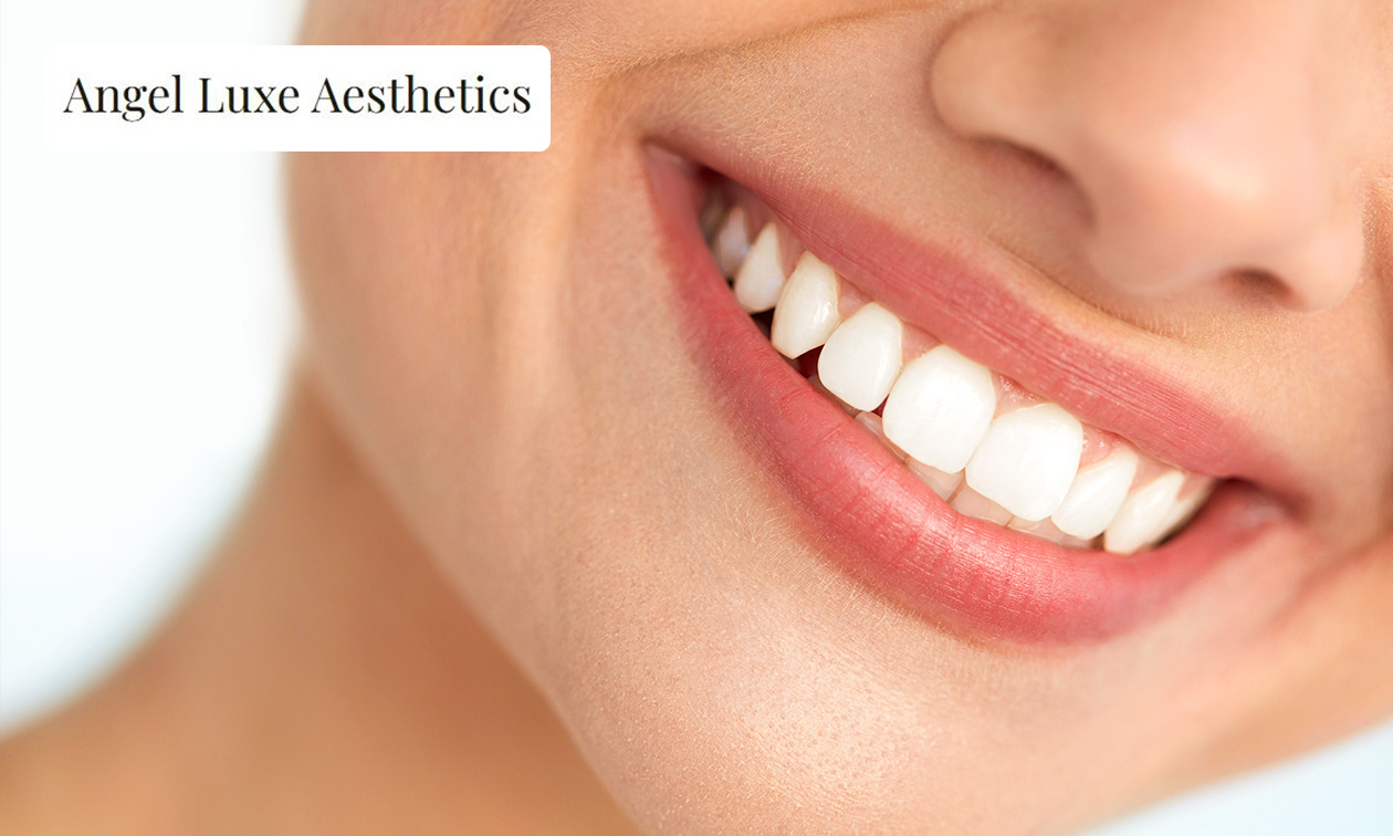 Angel Luxe Aesthetics