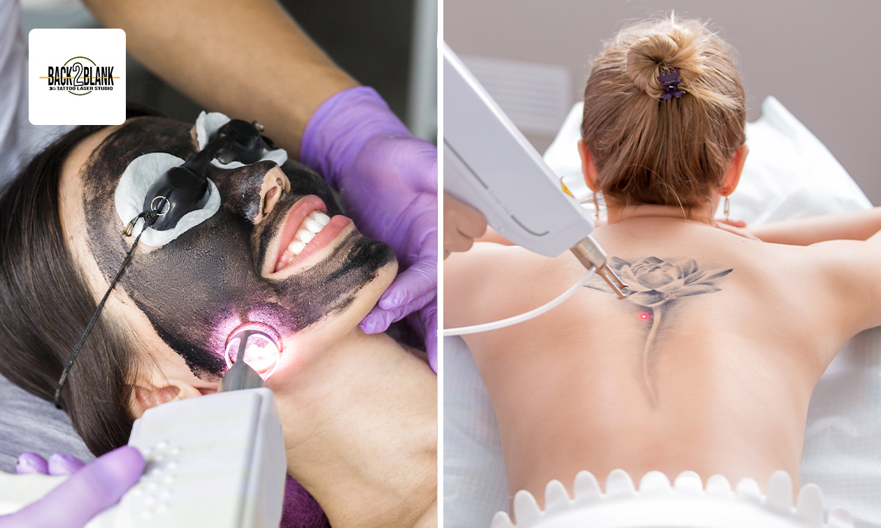 Back2Blank Laserstudio